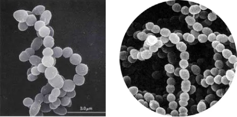 Gambar 2. Streptococcus thermophilus 