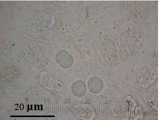 Gambar 3  Degradasi M. aeruginosa oleh isolat (a) NU-4 dan (b) NU-8. 