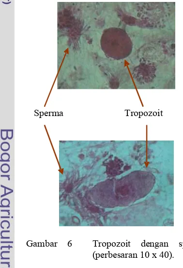 Gambar  6   Tropozoit  dengan  sperma 