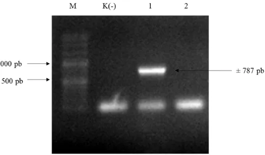 Gambar 10 Hasil verifikasi koloni yang membawa plasmid pC13-35S-Intron-eGFP (M= penanda 1000 pb DNA ladder; K(-)= kontrol negatif) 