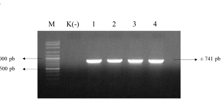 Gambar 14 Hasil verifikasi keberadaan T-DNA pC13-35S-Intron-Sma pada empat galur kalus transgenik (M= penanda 100 pb) 