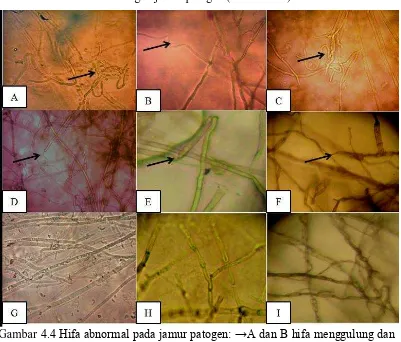 Gambar 4.4 Hifa abnormal pada jamur patogen: →A dan B hifa menggulung dan hifa bengkok pada R