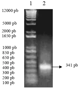 Gambar 7. Pita hasil PCR cDNA  