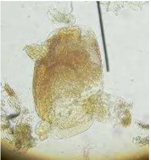 Gambar 11.  Tripalmaria sp. (40 x) (Octalia, 2007)