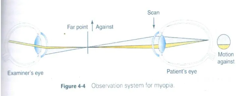 Gambar 1 : Sistem observasi untuk myopia( from fig. 4-4 American Academi of Ophthalmology, Clinical Optics, 2008-2009, p.127) 
