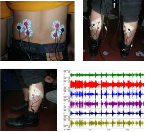 Figure 2.  Surface electrodes are attached over the erector spinae muscles (top left), gastrocnemius muscles (top right) and tibialis anterior muscles (bottom left) to detect electromyography signals (bottom right) 