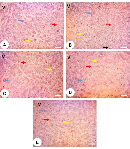 Gambar 4 Fotomikrograf jaringan hati yang diwarnai dengan pewarnaan karbohidrat netral (periodic acid Schiff), perbesaran objektif 10x