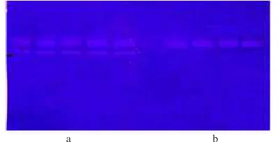 Fig 5  Effect of temperature on activity of L-23 enzyme.