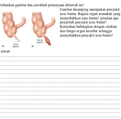 Gambar disamping merupakan penyakit