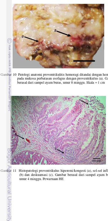 Gambar 10  Patologi anatomi proventrikulitis hemoragi ditandai dengan hemoragi 