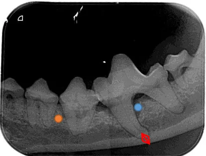 Gambar 3 Hasil radiografi gigi premolar dan molar dengan titik-titik lokasi pengukuran densitas 