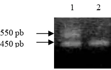 Gambar 3. Hasil PCR β-Aktin yang berasal dari cetakan cDNA murni. 