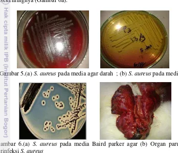 Gambar 5.(a) S. aureus pada media agar darah  ; (b) S. aureus pada media MSA  