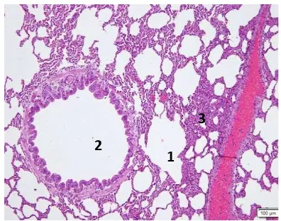 Gambar 10. Paru kelinci grup kontrol mengalami Pneumonia. 1. Alveolar dan 2. Broncheo-lus berisi sel darah merah