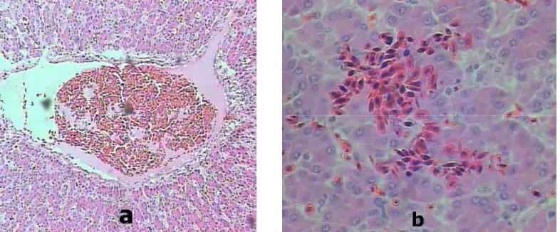 Gambar 5. Gambaran histopatologi hati broiler yang mengalami kongesti pada vena sentralis (a) pada perlakuan C (ransum terpilih, tanpa vaksin dan ditantang virus ND), (pewarnaan HE, pembesaran 10x ) dan Perdarahan (b) pada perlakuan D (ransum terpilih, vak