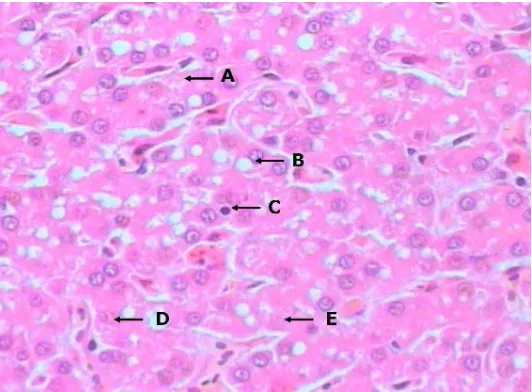 Gambar 6. Gambaran histopatologi hati broiler yang mengalami degenerasi dan nekrosa pada perlakuan E (ransum biasa, vaksinasi dan ditantang virus ND); Degenerasi berbutir (A), Degenerasi lemak (B), Inti mengalami piknotik (C), Inti mengalami karyoreksis (D