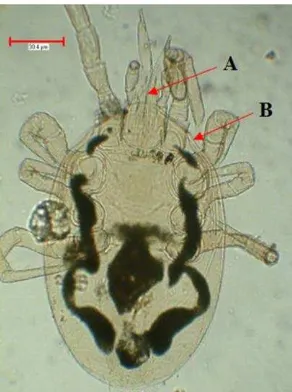 Gambar 6 Morfologi Cheyletidae (tampak dorsal) (A) Cakar apikal (B) Gnatosoma 