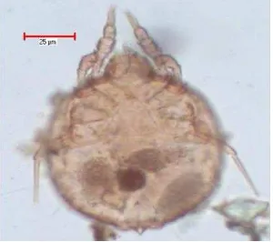 Gambar 7 Morfologi Tyrophagus spp (tampak vetral) 