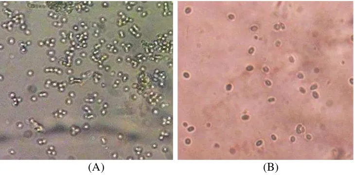 Gambar 4. Perbedaan spora jamur isolat Tegineneng dan Trimurjo secaramikroskopik (A) Spora isolat Tegineneng (B) Spora isolat Trimurjo.