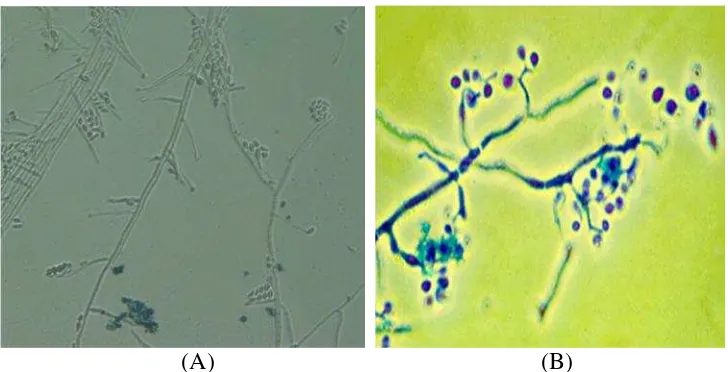 Gambar 5. Perbandingan hasil pengamatan stuktur jamur isolat Trimurjo denganliteratur (A) Struktur jamur isolat Trimurjo (Balai Veteriner, 2015)(B) Struktur jamur B