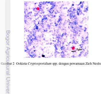 Gambar 2  Ookista Cryptosporidium spp. dengan pewarnaan Zieh Neelsen 