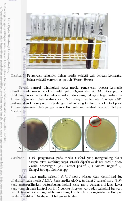 Gambar 3 Pengayaan sekunder dalam media selektif cair dengan konsentrasi 