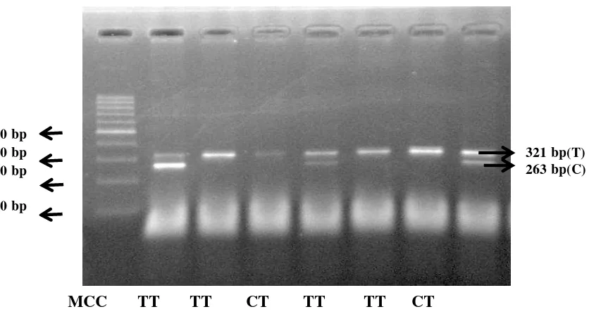 Gambar 1.Hasil Amplifikasi gen SCD1 dengan  panjang 343 bp, M = Marker 100bp,  1-14= individu sampel 