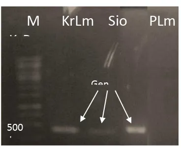 Gambar 1. Hasil Elektroforesis Sampel PCR Figure 1. The result of electrophoresis of PCR products 