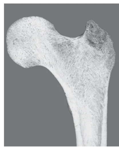 Figure 1. Section through a proximal femur (thigh bone) show-ing cortical (lower walls) and cancellous bone (center of thefemoral head).