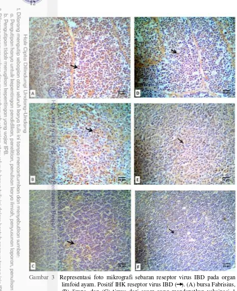 Gambar 3  Representasi foto mikrografi sebaran reseptor virus IBD pada organ  