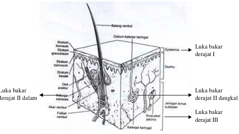 Gambar 2. Lokasi Luka Bakar dalam Anatomi Kulit (Effendy, 1999) 
