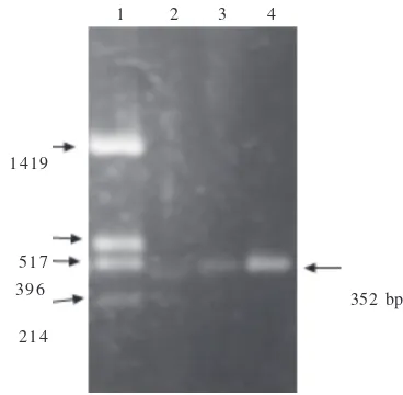 Figure 1  Electrophoregram of PCR product. Lane 1 shows