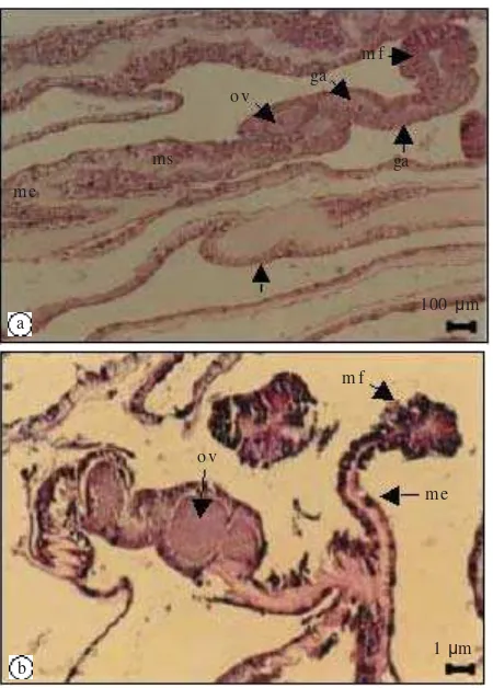 Gambar 3. Komponen umum ovarium karang. In: inti, an: anak inti,bl: butiran lemak, ko: membran kortikal, tr: trophonema,ga: gastrodermis.