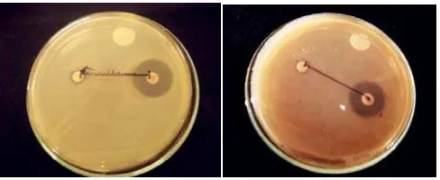 Gambar 7. Hasil Uji Aktivitas Antibakteri Kombinasi Amikasin dan Ampisilin  