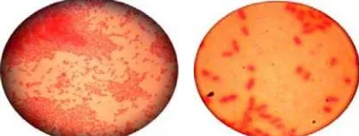 Gambar 2. Hasil Uji Identifikasi Bakteri dengan Pengecatan Gram 
