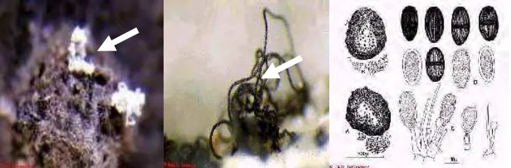 Gambar 2  Makros dan mikroskopik L. theobromae (sumber : CABI 2007)  