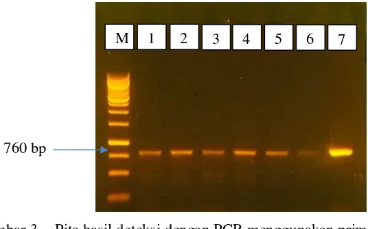 Gambar 3    Pita hasil deteksi dengan PCR menggunakan primer spesifik TYLCV terhadap sample stek no 105, 146, 122, 134, 33 dan 131 (masing-masing pada lajur ke 1, 2, 3, 4, 5 dan 6) dan kontrol positif yaitu contoh stek yang memperlihatkan gejala penyakit d