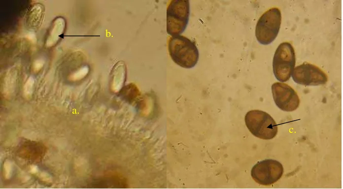 Gambar 5. Koloni B. theobromae; (A) umur 5 hari;  (B) umur 15 hari 