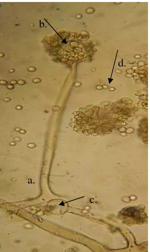 Gambar 9. Koloni Rhizopus sp.; (A) umur 10 hari; (B) umur 20 hari. 