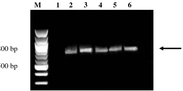 Gambar 3.3  Hasil amplifikasi RT-PCR dari tanaman cabai terinfeksi beberapa isolat ChiVMV menggunakan primer ChiVMV-F1 dan ChiVMV-R