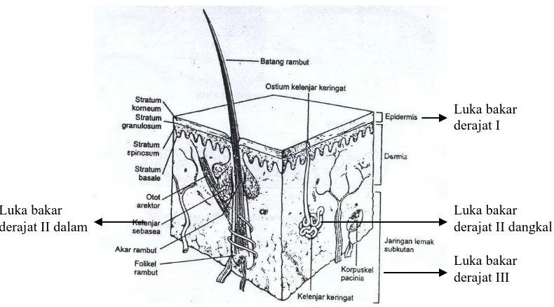 Gambar 1. Lokasi Luka Bakar dalam Anatomi Kulit  (Effendi, 1999)  