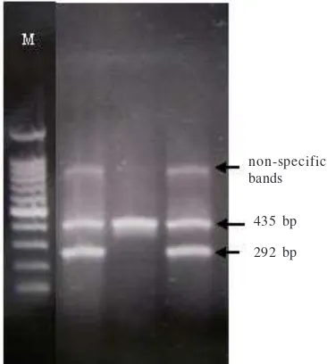 Fig 2  Profiles generated by multiplex PCR targeting katG315(note: the strains with amplified product of 292-bp were consideredto be wild-type, the strains with no amplified product of 292 bp wereconsidered to be mutant, M: 100 bp marker lane).