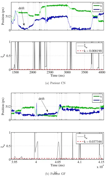Figure 6: Small portion of exploration made by patients: C-DT was insensitive to drifts,but failed in the case of artifacts such as spikes.