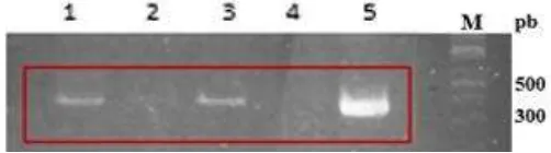 Gambar 18  Hasil PCR koloni menggunakan primer F/R gen fusi pada L. lactis 