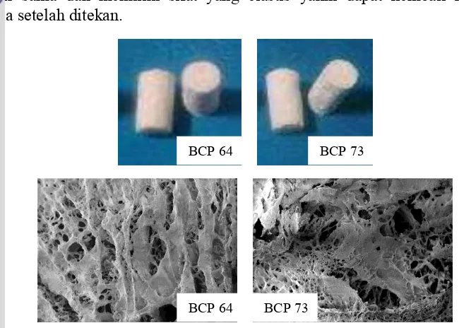 Gambar 4 Perancah berpori BCP 64 dan 73 beserta struktur porinya. 