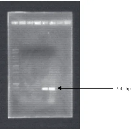 Figure 2  DNA electrophoresis of PCR amplification using specific