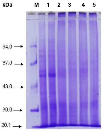 Gambar� 13� Elektroforegram� � total� protein��pada�cakram�daun�setelah�sampel�minggu�I�diencerkan.���