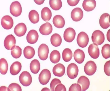 Gambar 3.  Sel-sel darah merah normal secara mikroskopis (Vidinsky, 2011). 