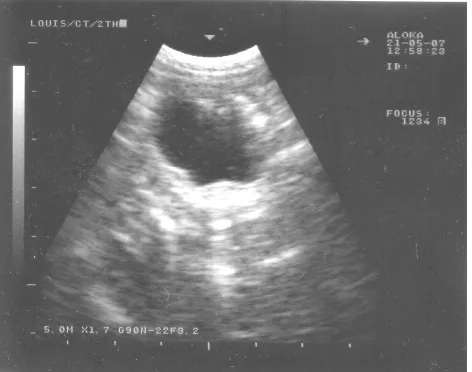 Gambar 3  Sonogram dari organ abdomen bagian hipogastrikus normal       yang tidak memperlihatkan adanya uterus