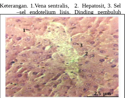 Gambar-gambar Foto Mikroskopis Jaringan hati dari berbagai dosis ekstrak daun capo